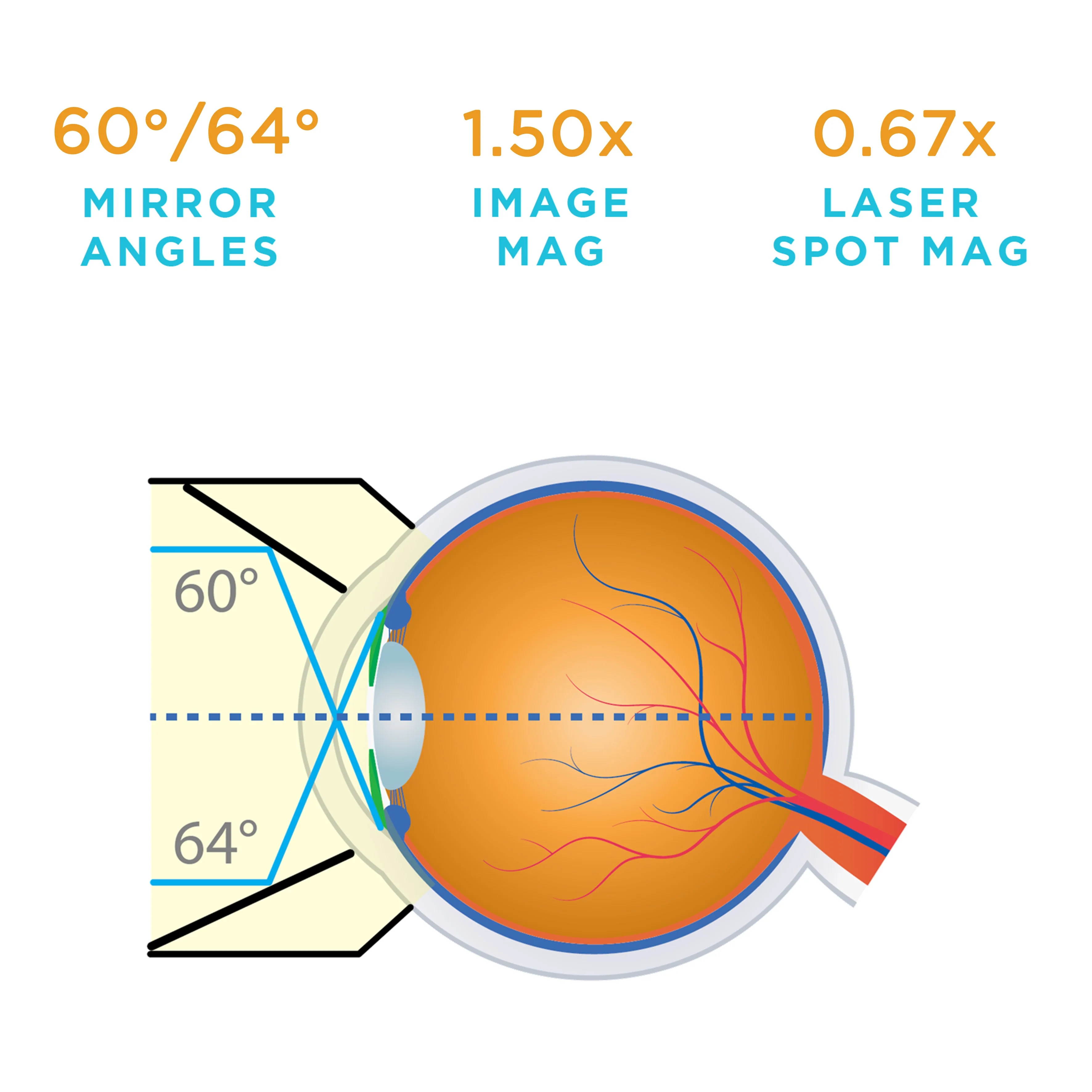 G-2 Gonio Lens - Image 3