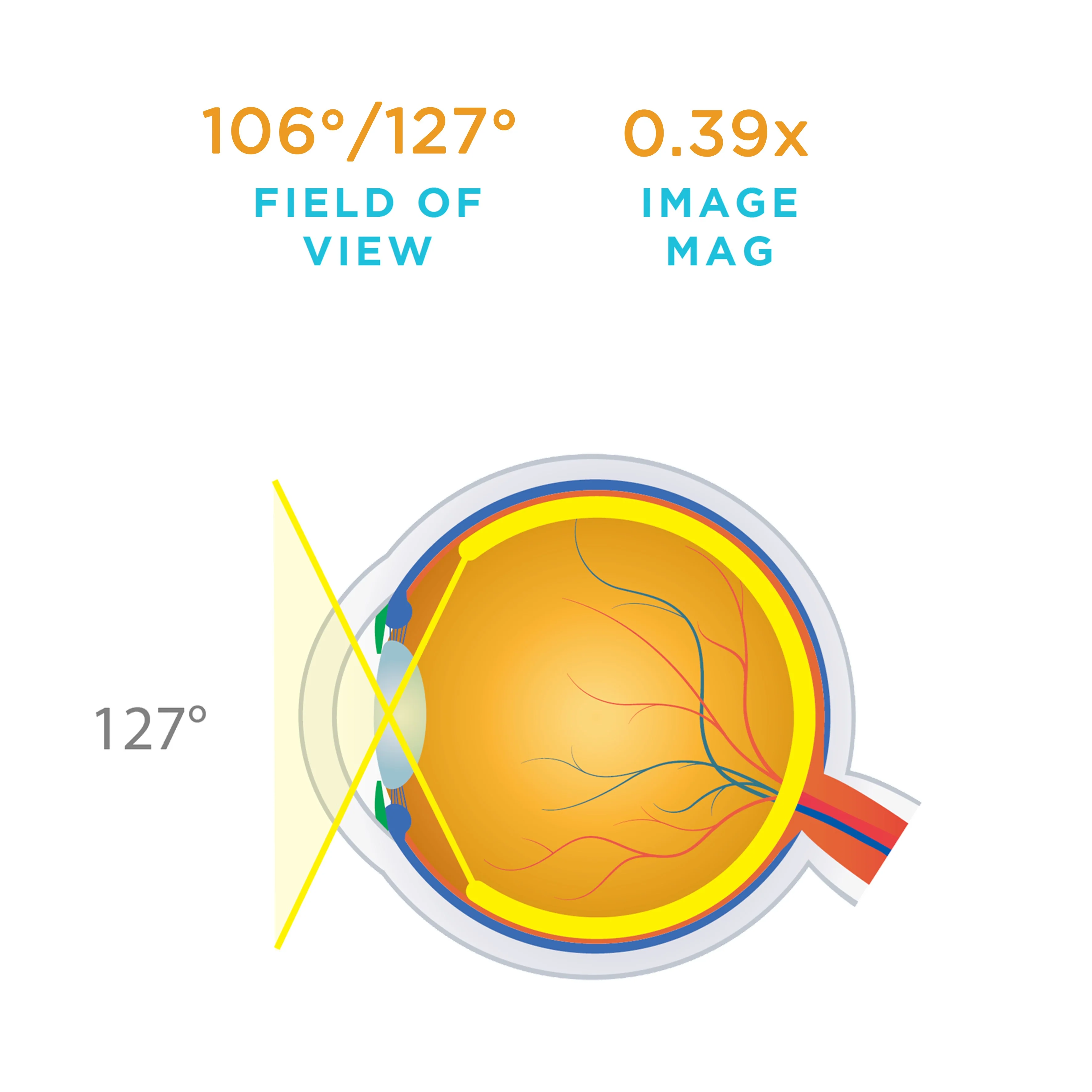 Mini Quad® Lens - Image 5